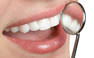 cost of teeth whitening