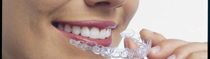 invisalign